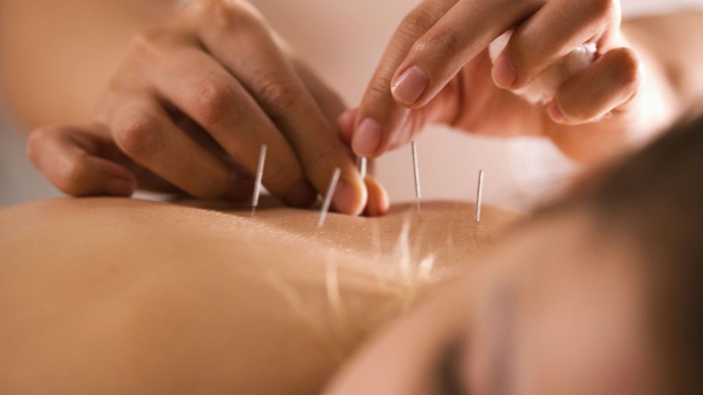 Five Element Acupuncture example photo